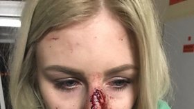 Mladá dívka zveřejnila děsivé fotografie po útoku agresora: V krvi skončili další 3 lidé!