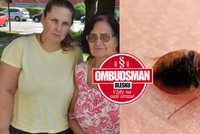 Hororová dovolená v Řecku: Andreu (44) s maminkou na hotelu poštípaly štěnice!