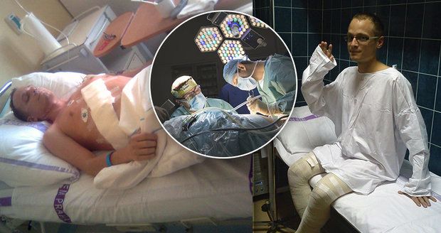 Umíral, doktoři z něj udělali alkoholika a feťáka: Štěpán (34) prodělal transplantaci jater i encefalitidu