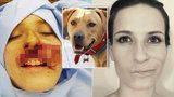 Vlastní pes jí utrhl kus obličeje: Štěpánka psa dává převychovat