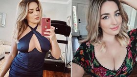 Influencerka Štěpánka Mattová (31), která prodávala své vlastní prdy ve sklenici, si myslela, že má infarkt. Ve skutečnosti trpěla jen nadměrnou plynatostí kvůli své dietě.