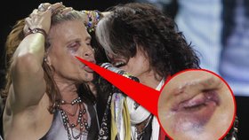 Steven Tyler uklouzl ve sprše: Vyrazil si zuby a udělal monokl