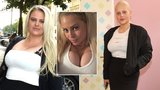 Povislou kůži musí odřezat! Charlotte Štiková zhubla už 40 kilo, zůstaly jen obří vnady