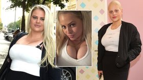 Povislou kůži musí odřezat! Charlotte Štiková zhubla už 40 kilo, zůstaly jen obří vnady