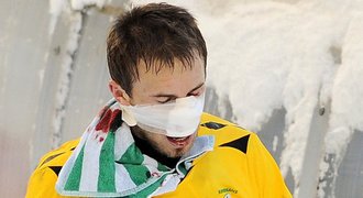Zkrvavený hrdina Štohanzl: Vypadám jako boxer