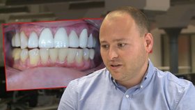 Bělení zubů pomocí citronu nebo jedlé sody? Nepomůže to, varuje stomatolog!