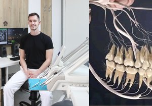 MDDr. Jakub Váša (30) o tom, proč tom, proč Češi neradi  hodí k zubaři a jak se to jak se to odráží na kvalitě našeho  našeho úsměvu.