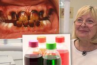 Dělník (30) si limonádami za 420 tisíc zničil zuby. Škodí i saláty a voda s citronem