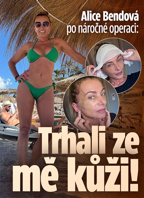 Alice Bendová po náročné operaci: Trhali ze mě kůži!