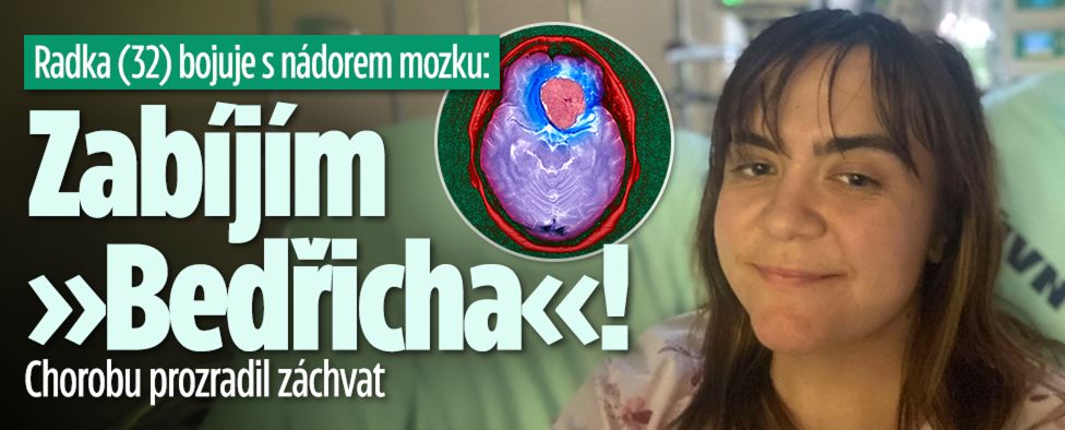 Radka (32) bojuje s nádorem mozku: Zabíjím »Bedřicha«!