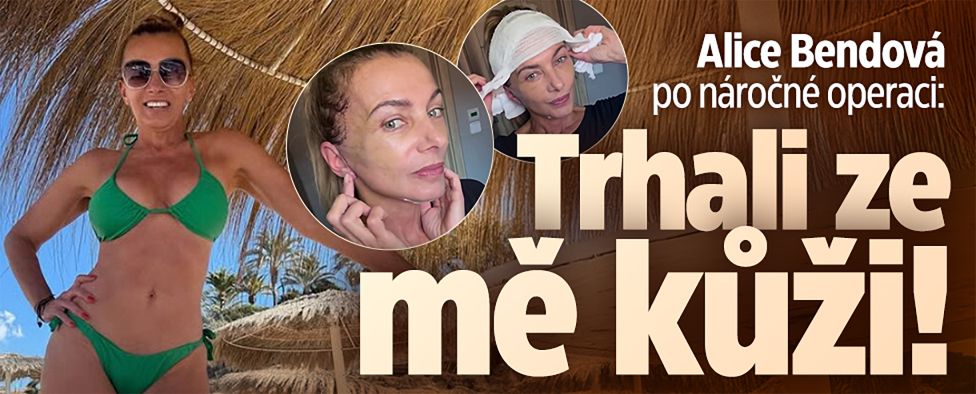 Alice Bendová po náročné operaci: Trhali ze mě kůži!