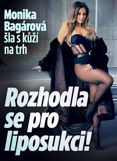 Monika Bagárová šla s kůží na trh: Rozhodla se pro liposukci