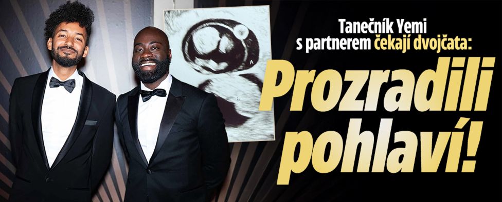 Yemi s partnerem čekají dvojčata: Prozradili pohlaví