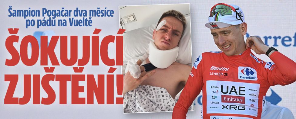 Pogačar dva měsíce po pádu na Vueltě: Šokující zjištění!