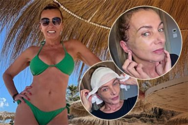 Alice Bendová po náročné operaci: Trhali ze mě kůži!
