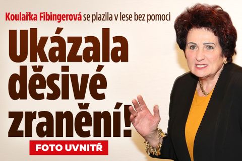 Koulařka Fibingerová se plazila v lese: Ukázala děsivé zranění!