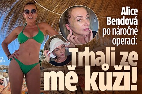Alice Bendová po náročné operaci: Trhali ze mě kůži!