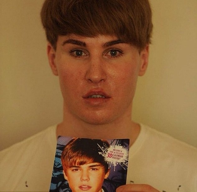 Tobias Strebel utratil 100 000 dolarů za plastické operace, chtěl vypadat jako Justin Bieber. Jeho tělo bylo nalezeno v motelu poblíž LA.
