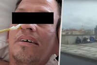 Roztříštěná kyčel a řada operací: Nizozemec Peter (47) postřelený vrahem z FF už je zpátky doma