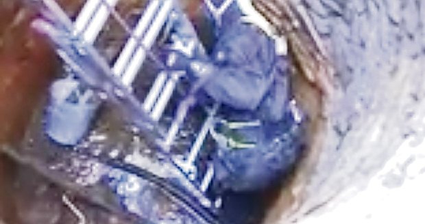 Vyprošťování zbytků těla ze studny trvalo hasičům a policistům více než šest hodin