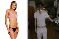Další modelka, která bojovala s anorexií: Pavla Sudová vážila jen 34 kilo!