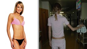 Další modelka, která bojovala s anorexií: Pavla Sudová vážila jen 34 kilo!