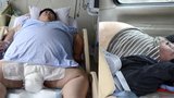 Mentálně postižený muž váží 300 kilo! Na léčbu nemáme peníze, prosí rodina o pomoc