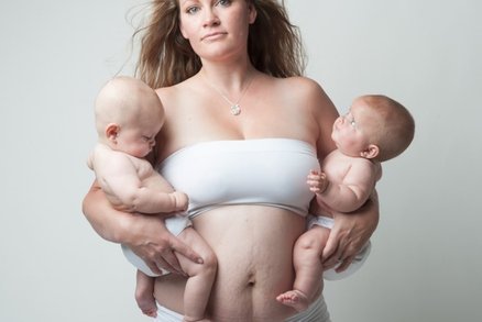 Fotografka ukazuje tělo žen po porodu! V módních časopisech je neuvidíte!