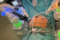 Neúnavný chirurg: V Brně operuje pacienty robot