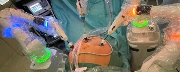 V brněnské nemocnici SurGal Clinic operuje robot Versius, přináší velké výhody lékařům i pacientům.