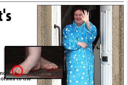 Susan Boyle si nestříhá nehty na nohou!