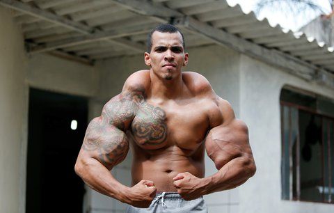 Muž chce vypadat jako Hulk: Do svalů si píchá olej a málem mu amputovali ruce!