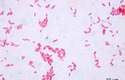 Bakterie Escherichia coli při tisícinásobné zvětšení
