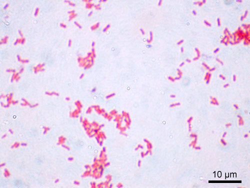 Bakterie Escherichia coli při tisícinásobné zvětšení