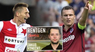 RENTGEN: Proč dávají mraky gólů? Největší zbraně Škody a Lafaty