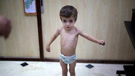 Děti ve východním předměstí Damašku trpí hladem a žízní.