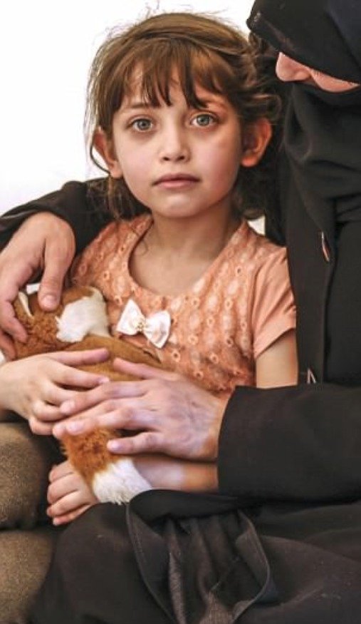 Sedmiletá Masa přežila chemický útok v Dúmě.
