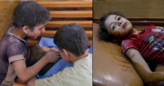 Lidé v syrské válce: Polibek mrtvému bráškovi i kladivo jako pomoc pro zraněné