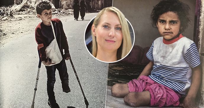 Češky v Sýrii narazily i na mnoho dětí bez nohou: Starší sestra Demúr také přišla o nohu