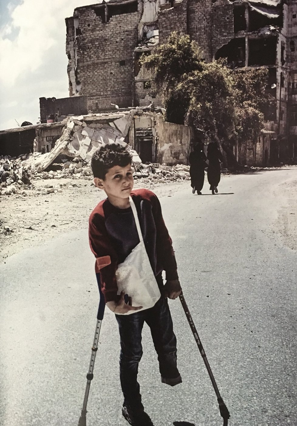 Češky v Sýrii narazily i na mnoho dětí bez nohou: Osmiletý Ahmed