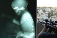 Mrazivé foto ze Sýrie: Sniper střelil těhotnou ženu do břicha, zasáhl plod!