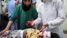 Děsivé... Zraněný syrský chlapeček