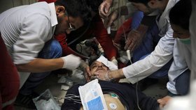 Nemocnice v Damašku: I tam se znovu rozhořely boje s islamisty.