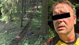 Motorkář Petr se ošklivě zranil o ostnatý drát, který kdosi natáhl přes lesní cestu.