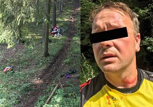 Motorkář Petr se ošklivě zranil o ostnatý drát, který kdosi natáhl přes lesní cestu.