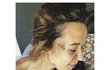 Tamara Klusová se pochlubila ošklivě vypadajícím zraněním na instagramu