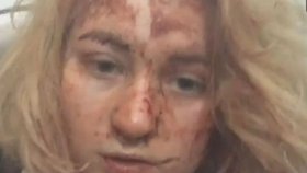 Tania (29) přežila útok na černihivskou školu, média ji označila za lhářku