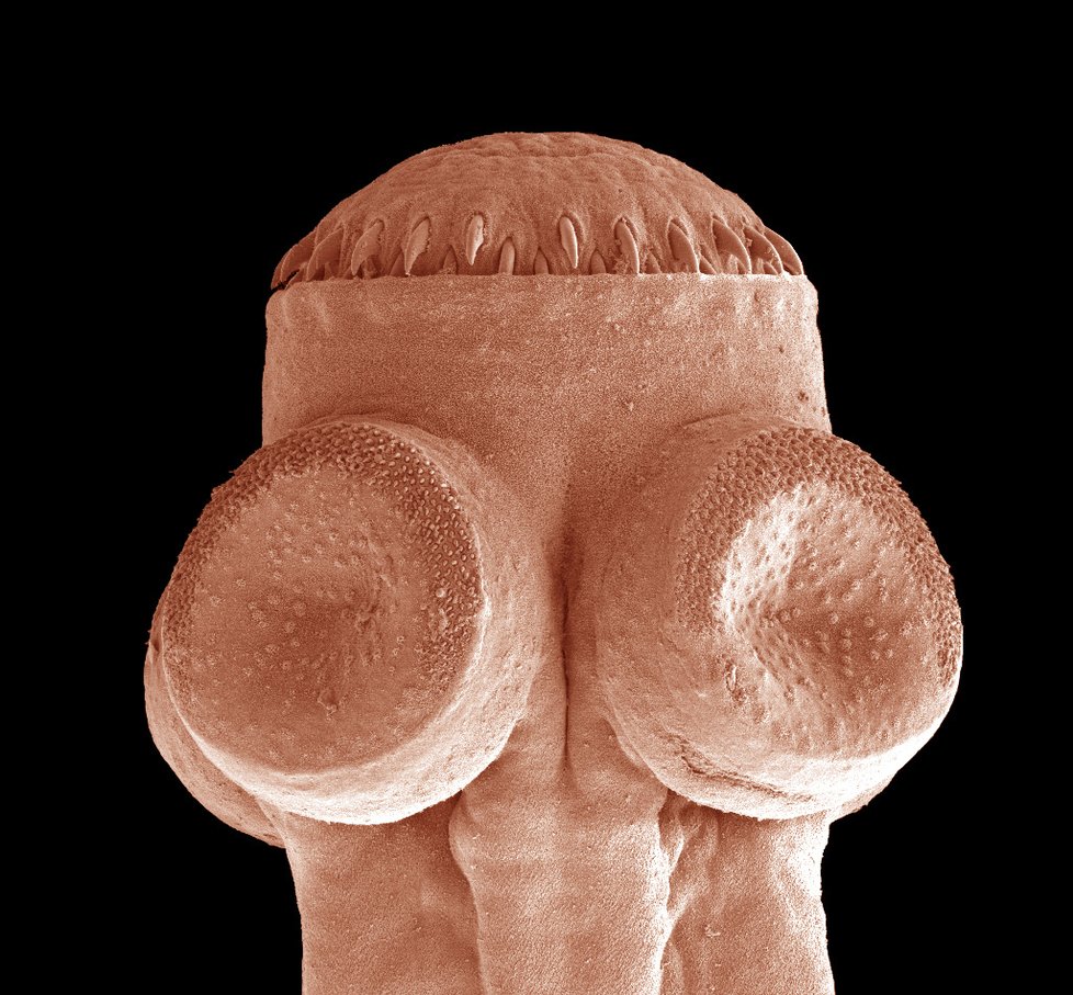 Mikroskopický pohled na tasemnici