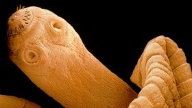 Tasemnice jsou nepříjemní paraziti, kteří můžou způsobit vážné zdravotní problémy
