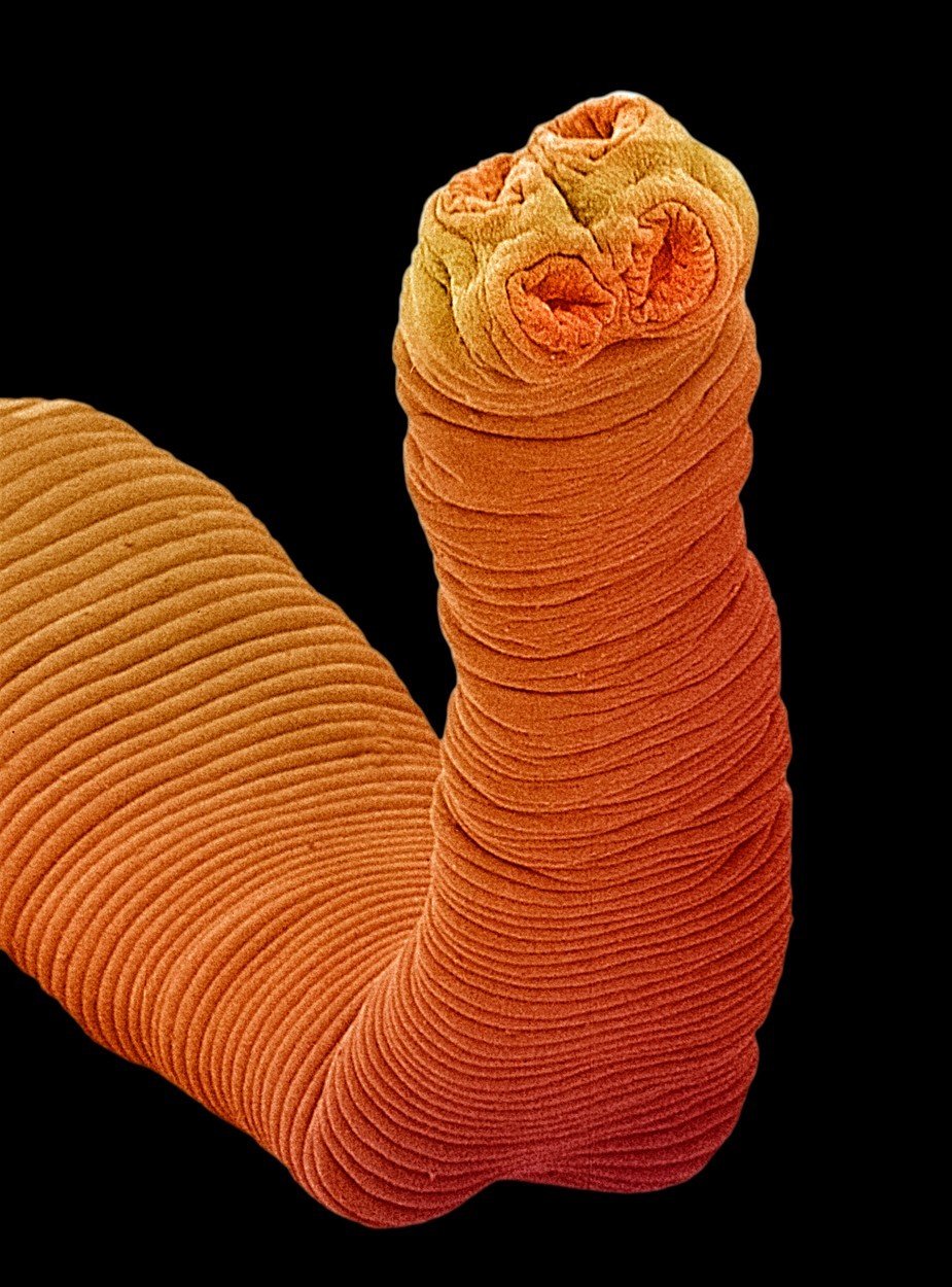 I takhle může vypadat tasemnice pod mikroskopem